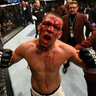 Nate Diaz