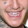 silver smile